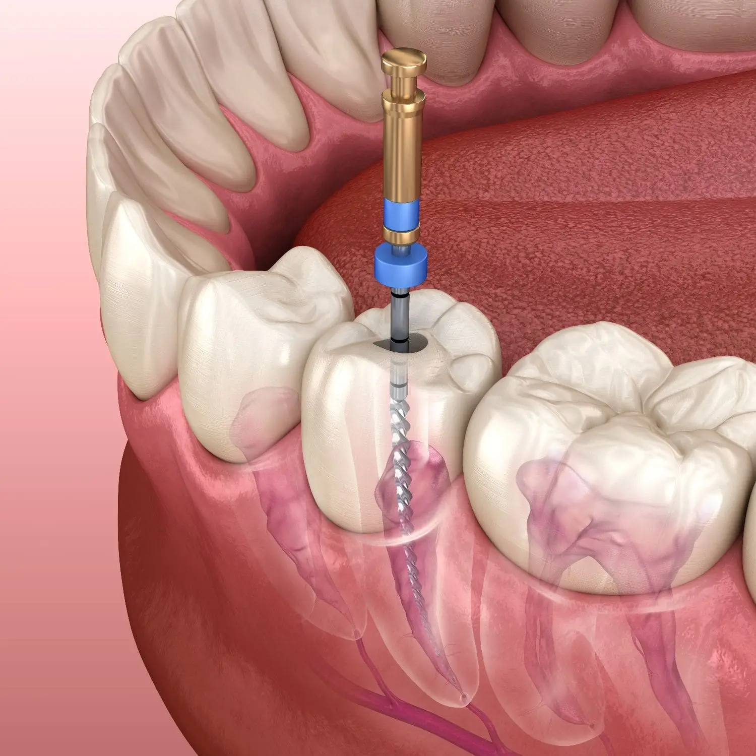 Endodontie